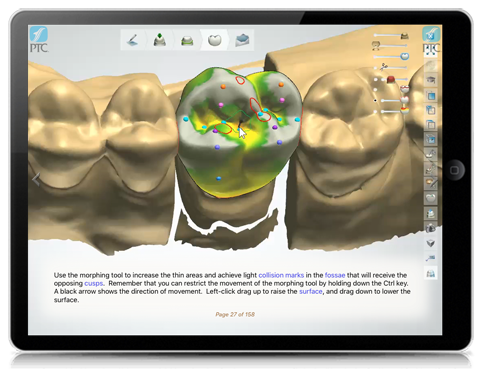 3Shape Crowns