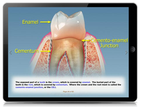 Slide 4