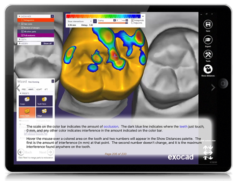 exocad Intro