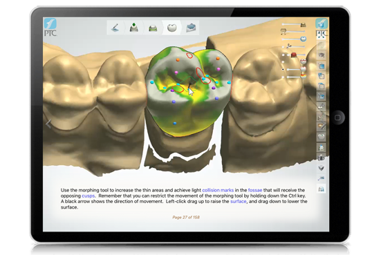 Dental CAD