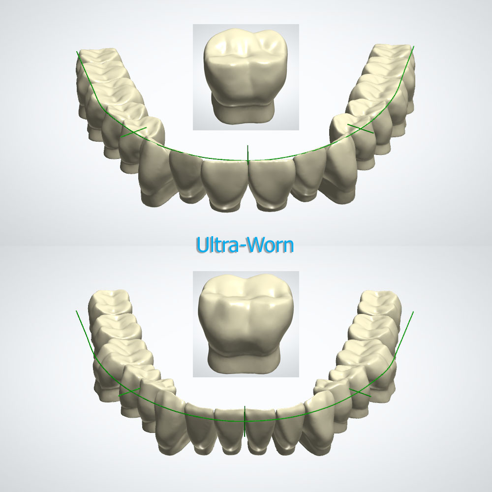 PTC Ultra-Worn