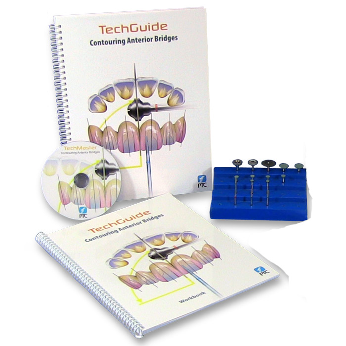 Contouring Anterior Bridges