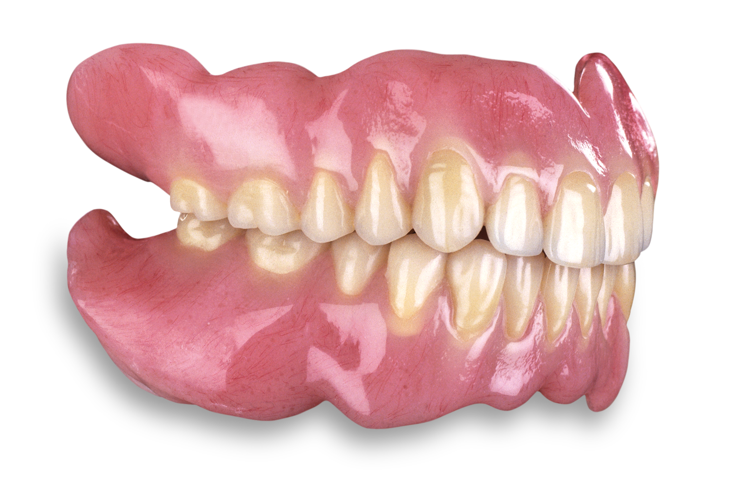 Denture